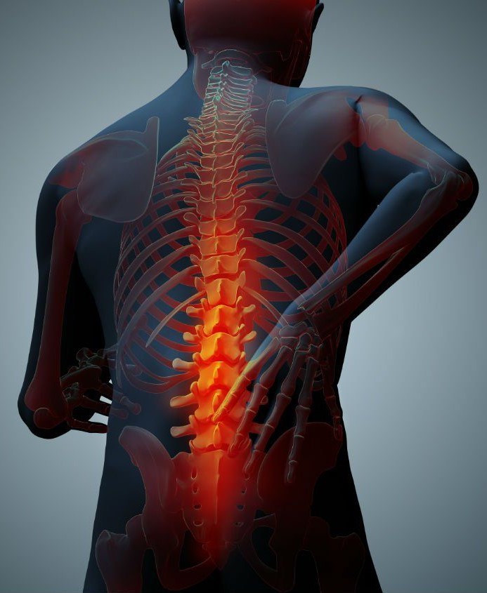 Qualified Back Injury Lawyer in Toronto